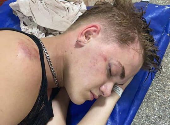 Співробітнику УДО, що побив танцюриста шоу-балету DOROFEEVA, повідомили про підозру | Новинарня