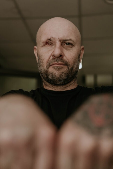 У Києві стартує місія Vision for Ukraine. Американські та українські хірурги відновлюють риси обличчя військових за допомогою 3D-друку_3