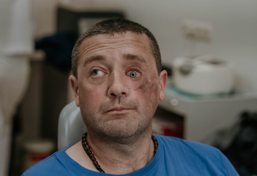 У Києві стартує місія Vision for Ukraine. Американські та українські хірурги відновлюють риси обличчя військових за допомогою 3D-друку_4